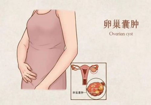 刚怀孕肚子的变化有这些，看看这些信号吧！