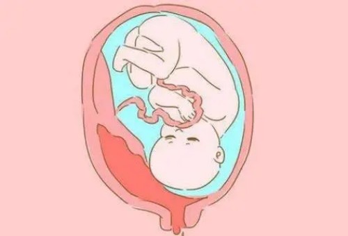 深圳试管婴儿价格：胆核磁共振检查什么,做胆核磁共振检查的作用是什么