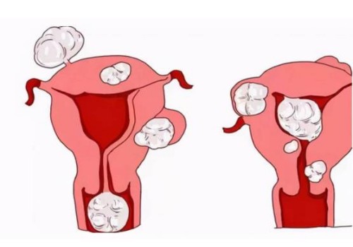 现在有第四代试管婴儿了吗,四代试管婴儿成功率